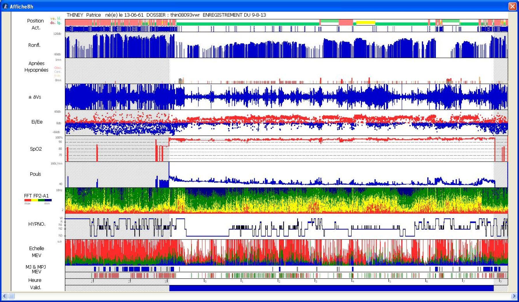 on reparle des troubles du sommeil